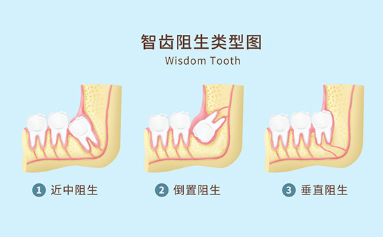 全新公布：盐城种植牙医院网站[排名]前三强_推荐排名！盐城多少钱能种植一颗牙