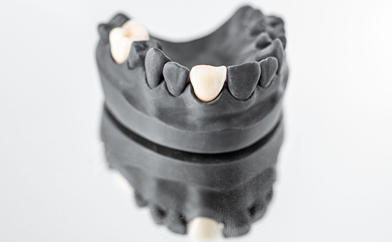 南京哪里人工种植牙好排行-Dentium种植牙(图2)