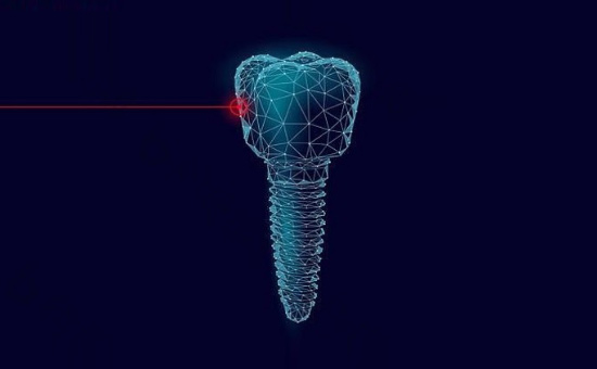 烤瓷牙多少钱一颗价格表2024_种牙哪个国·家的牙好